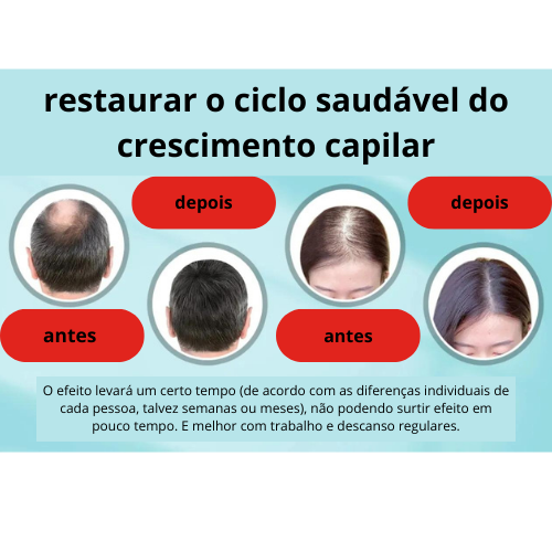 "Boné de Crescimento Capilar com Dispositivos de Terapia de Luz Vermelha LED para Anti Queda de Cabelo, Alívio da Ansiedade, Estresse e Dor de Cabeça"p Relax Massager Helmet